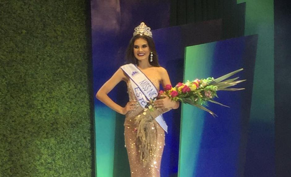 Estelianos destacan partición de Ana Marcelo en Miss Universo